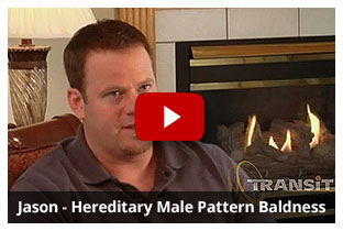 Jason - Male Pattern Baldness
