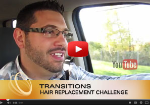 Non-Surgical Men's Hair Replacement Challenge