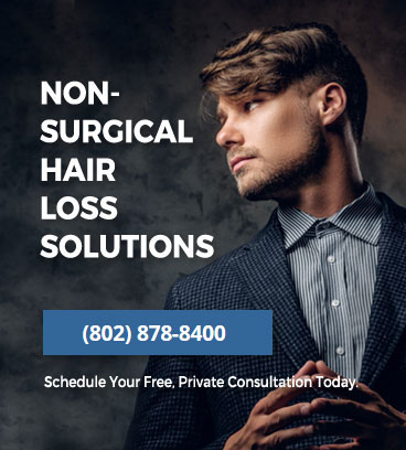 Vermont hair replacement specialists