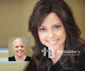 Alopecia Chemotherapy Wigs. Burlington Vermont
