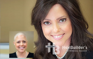 Alopecia Chemotherapy Wigs. Burlington Vermont