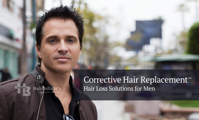 hair replacement for men. Burlington Vermont