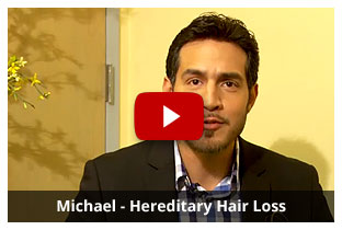 Michael - Hereditary Hair Loss