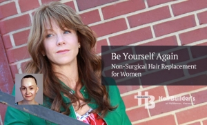 Womens hair restoration. Burlington Vermont