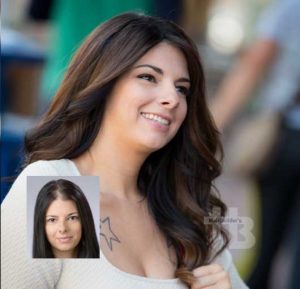 female hair loss replacement pieces vermont