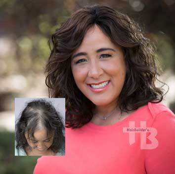 womens hair loss replacement wigs toppers burlington vt