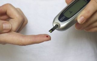 diabetes hair loss connection