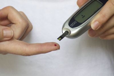 diabetes hair loss connection