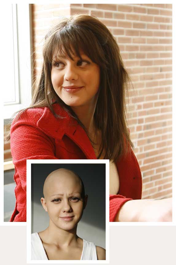 Wigs-for-alopecia-chemotheapy-trichotillomania-HairBuilders-Williston-Vermont mens non-surgical hair replacement specialists burlington vermont