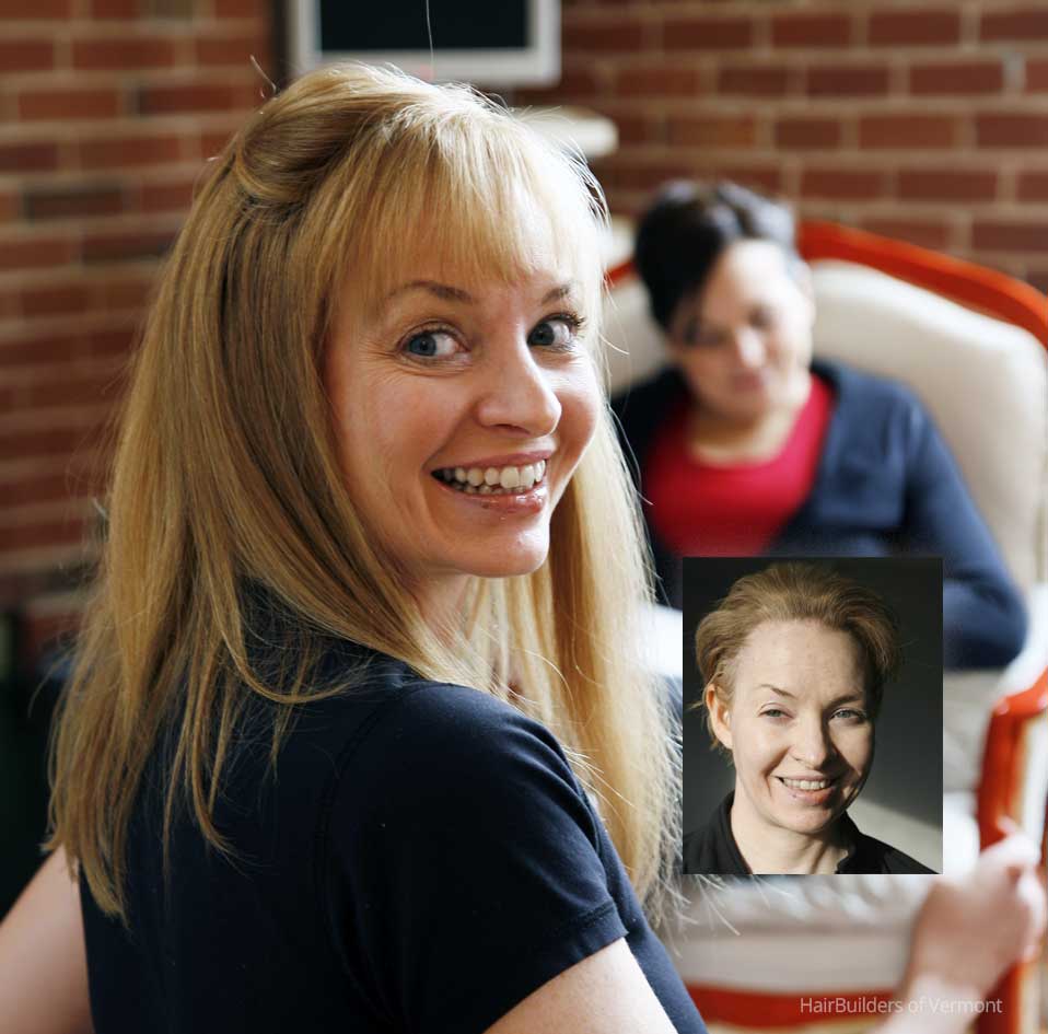Womens-wigs-for-alopecia-and-thinning-hair-HairBuilders-Williston-Vermont Womens wigs for alopecia and thinning hair HairBuilders Williston Vermont