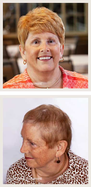 best-womens-non-surgical-hair-replacement-vermont-Hairbuilders-Williston best womens non-surgical hair replacement vermont Hairbuilders Williston