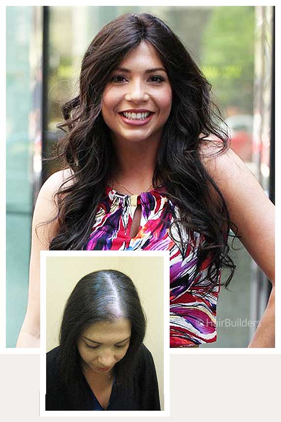 womens-hair-replacement-HairBuilders-Williston-Vermont womens non-surgical hair restoration systems Hairbuilders Williston VT