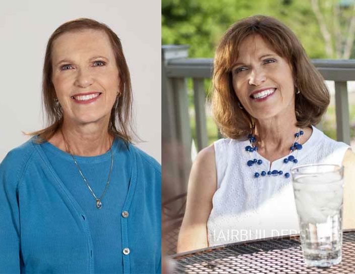 female-hair-loss-solutions-results-hairbuilders-burlington-vermont men's non-surgical hair loss solutions results at HairBuilders in Williston VT