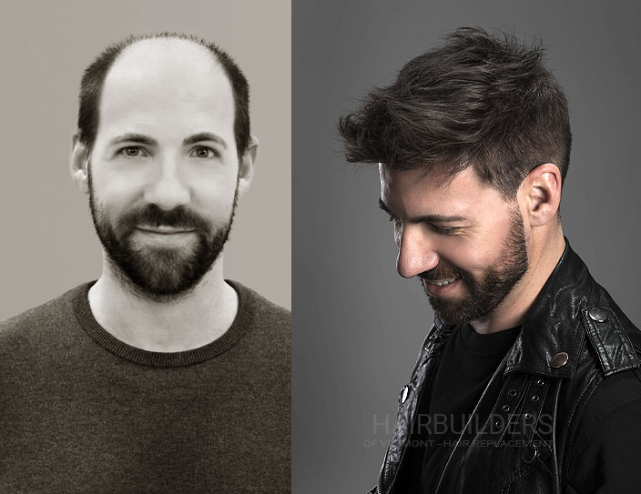 hair-replacement-for-male-pattern-baldness-burlington-vermont-hairbuilders men's non-surgical hair loss solutions results at HairBuilders in Williston VT