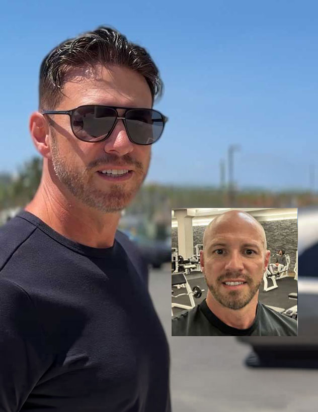 Men's Hair Restoration at HairBuilders in Williston VT