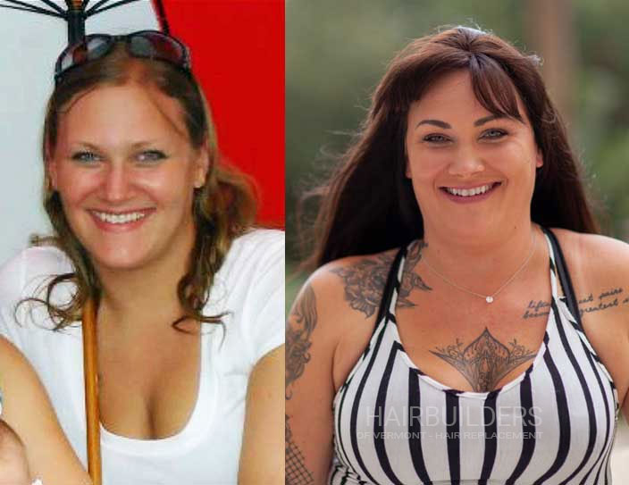 womens-non-surgical-hair-replacement-results-at-HairBuilders-in-Williston-VT women's non-surgical hair replacement results at HairBuilders in Williston VT