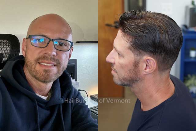 mens-custom-hair-systems-burlington-vt Hairbuilders of Vermont - Custom hair systems for men