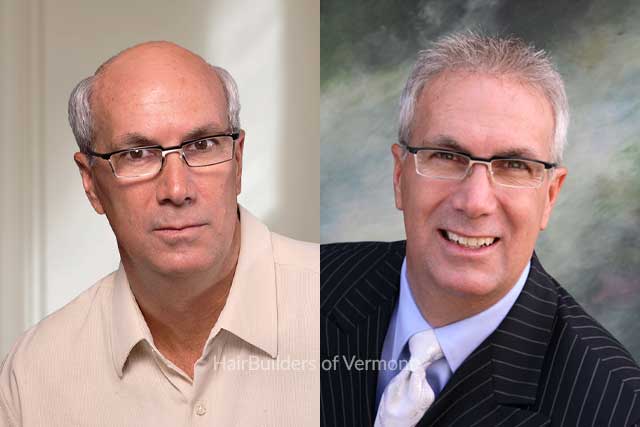 mens hair systems burlington vermont mens non-surgical hair replacement before after HairBuilders Williston Vermont
